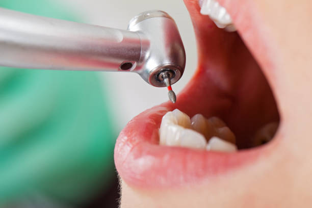 Best Emergency Gum Treatment in Saratoga Springs, NY